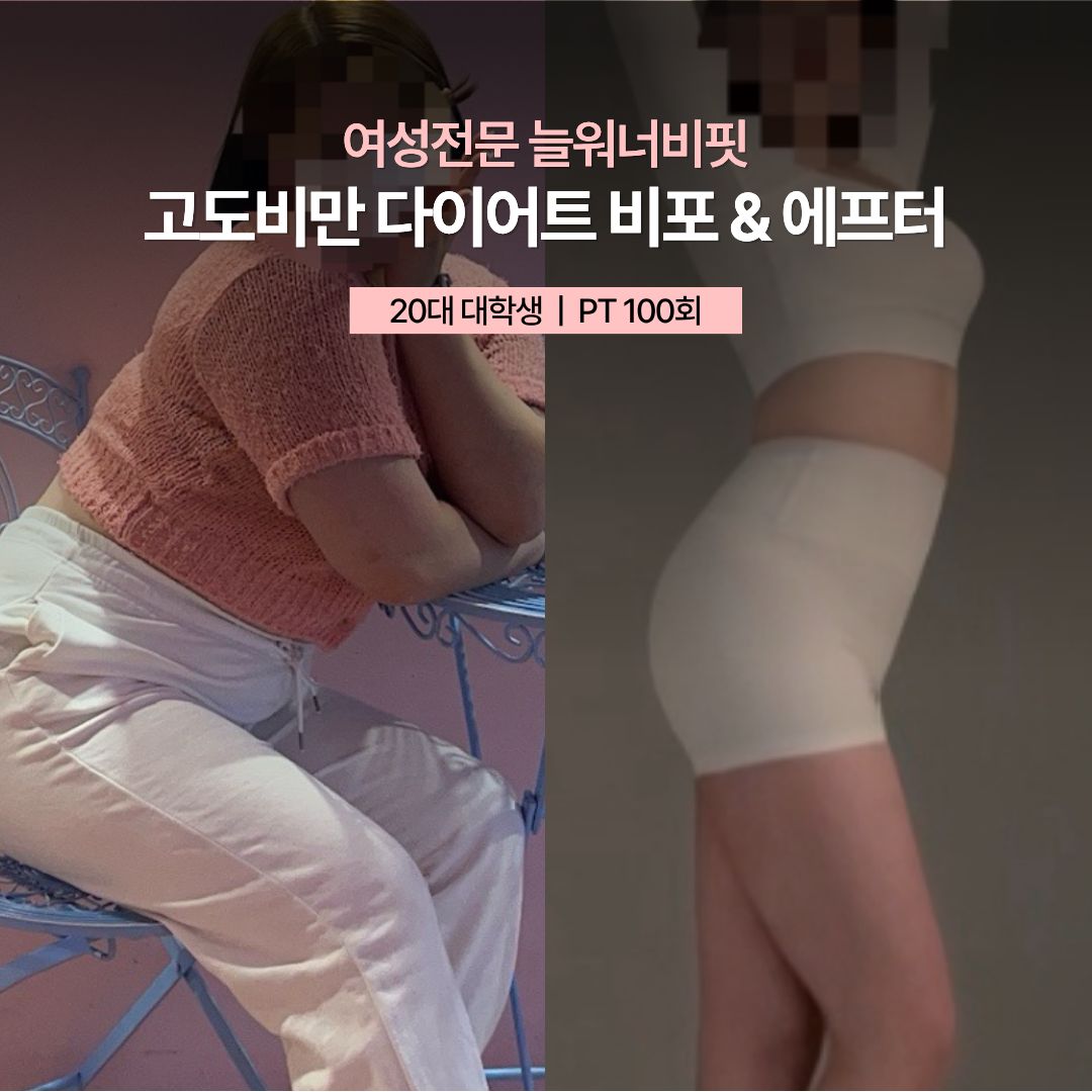 고도비만 다이어트 비포 애프터 — 20대 대학생 · PT 100회