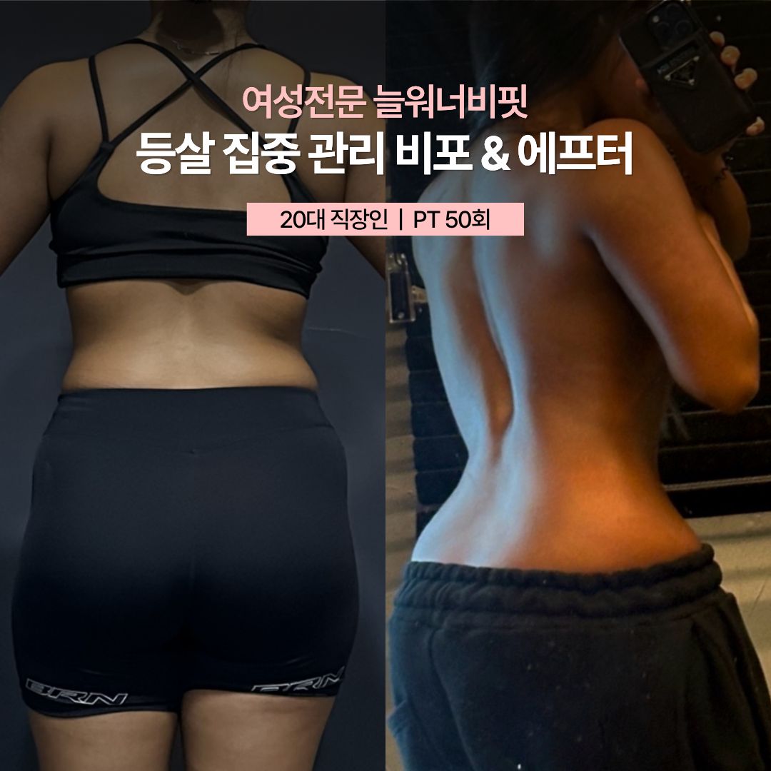 등살 집중 관리 비포 애프터 — 20대 직장인 · PT 50회