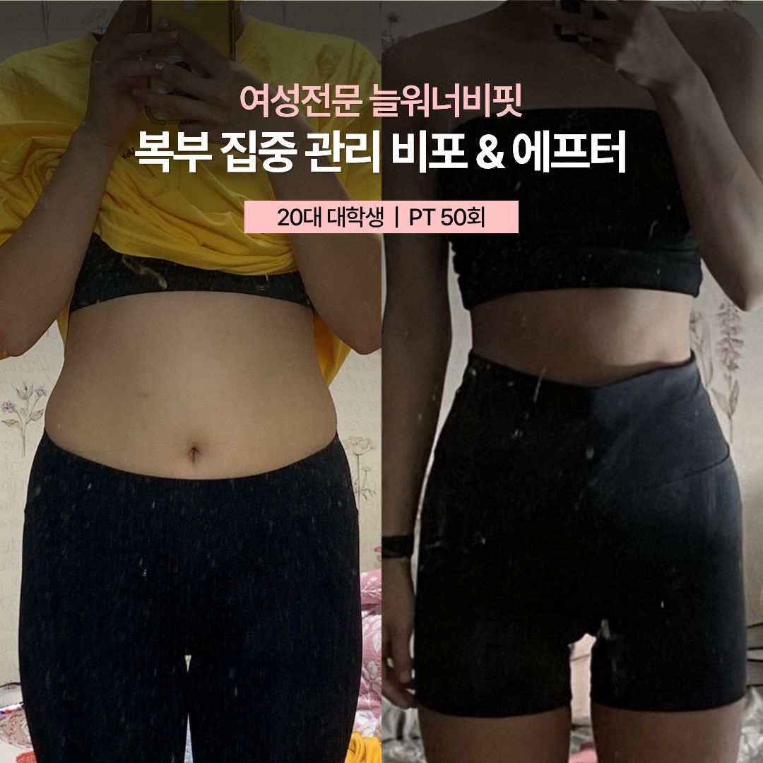 복부 집중 관리 비포 애프터 — 20대 대학생 · PT 50회