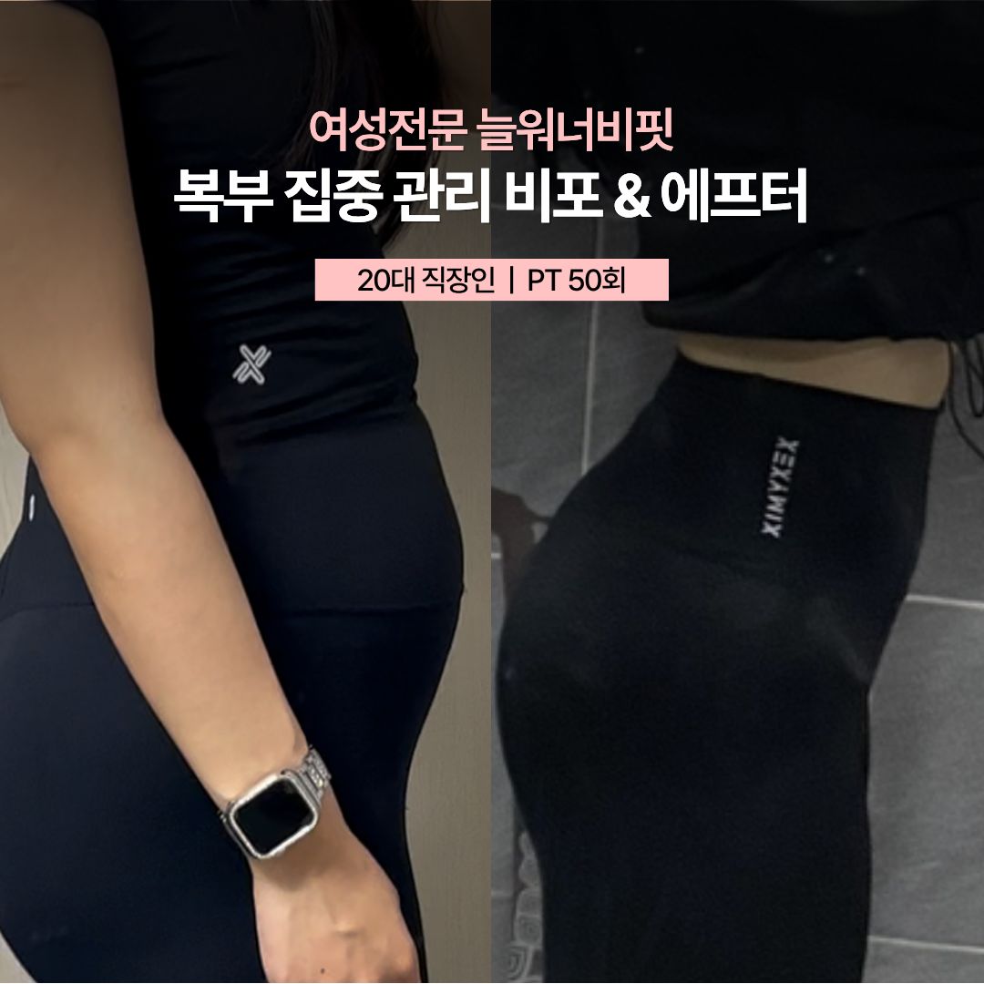 복부 집중 관리 비포 애프터 — 20대 직장인 · PT 50회