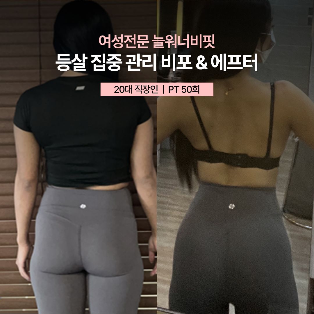 등살 집중 관리 비포 애프터 — 20대 직장인 · PT 50회