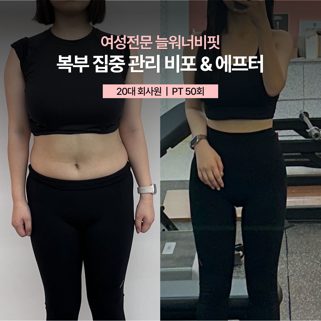 복부 집중 관리 비포 애프터, 20대 회사원 · PT 50회