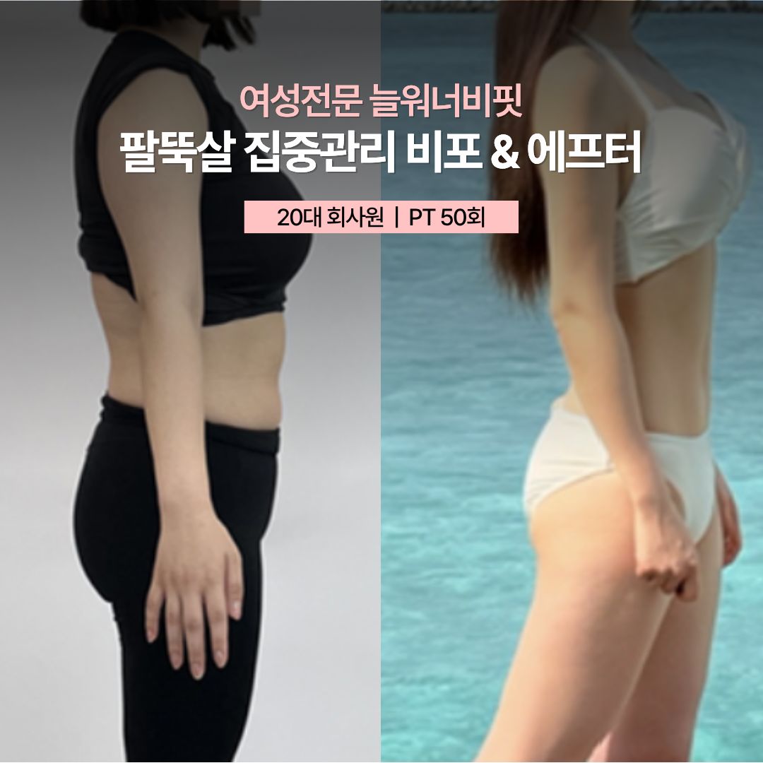 팔뚝살 집중관리 비포 애프터, 20대 회사원 · PT 50회