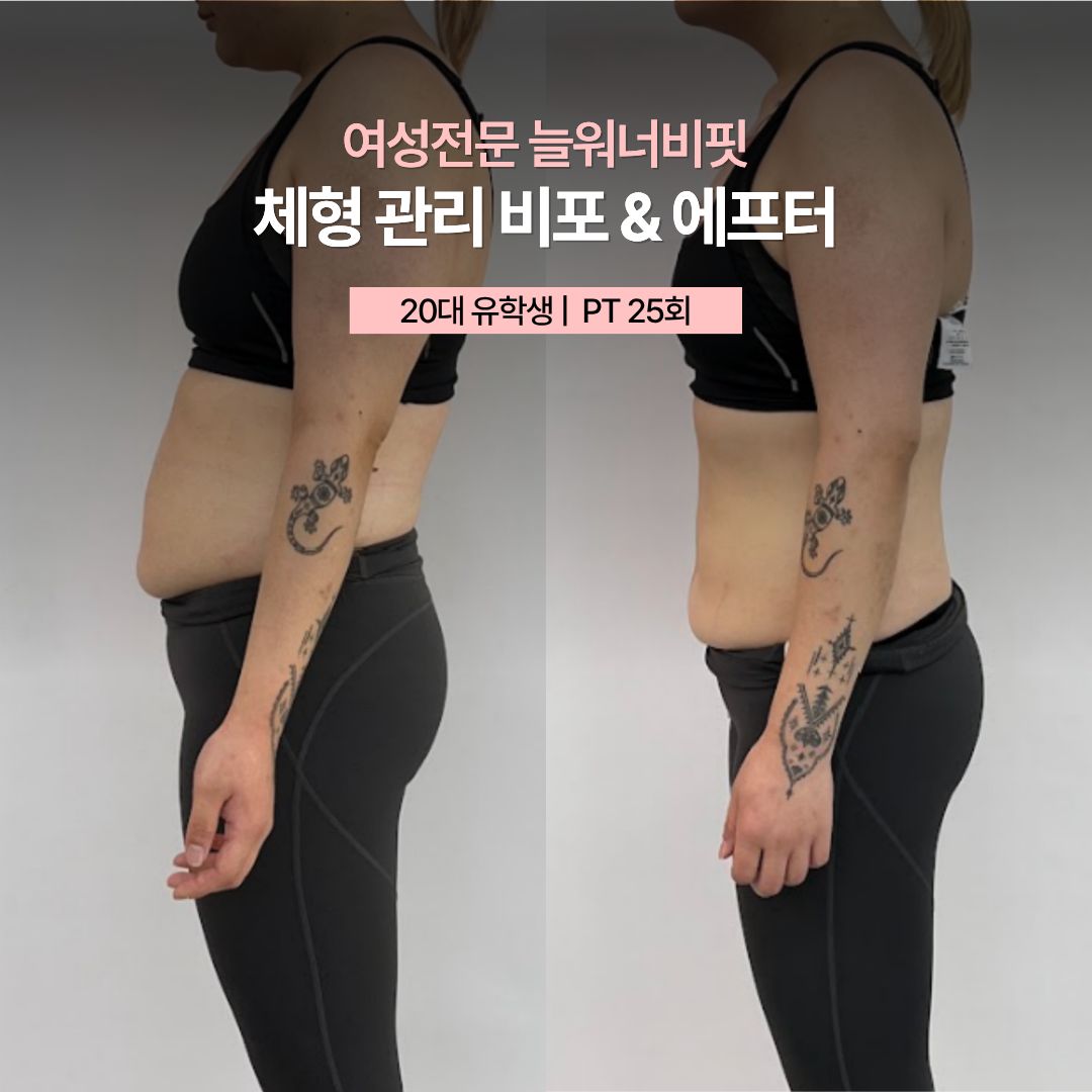체형 관리 비포 애프터, 20대 유학생 · PT 25회