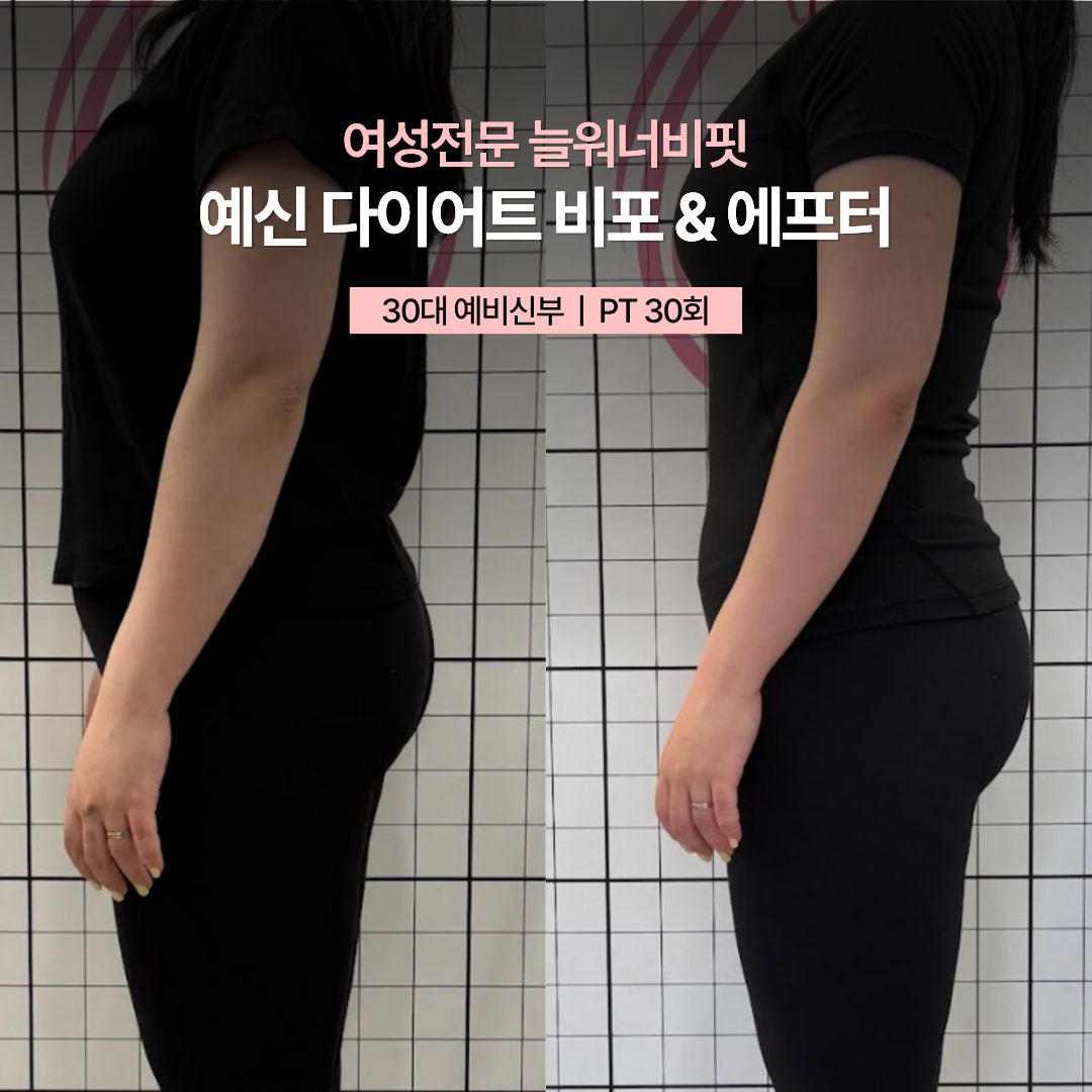 예신 다이어트 비포 애프터, 30대 예비신부 · PT 30회