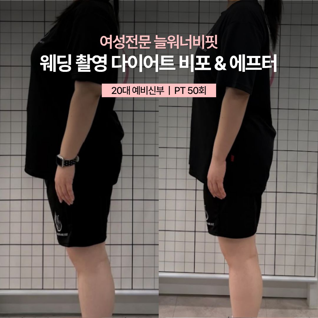 웨딩 촬영 다이어트 비포 애프터, 20대 예비신부 · PT 50회
