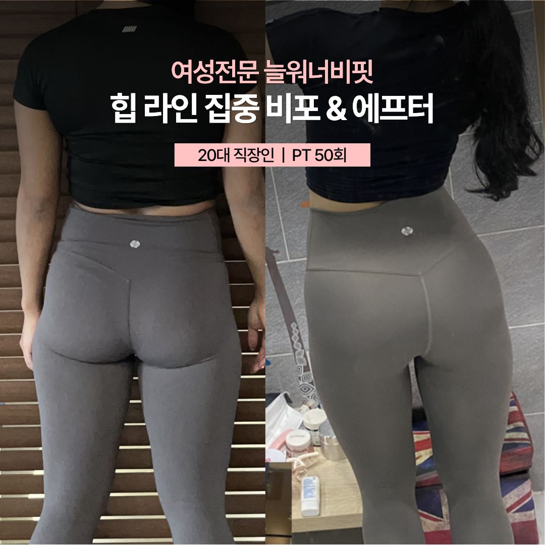 힙 라인 집중 비포 애프터, 20대 직장인 · PT 50회