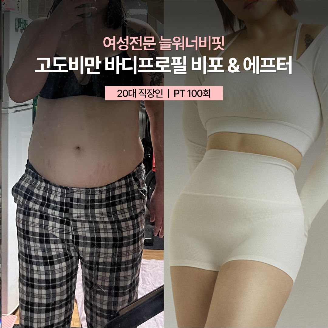 고도비만 바디프로필 비포 애프터, 20대 직장인 · PT 100회