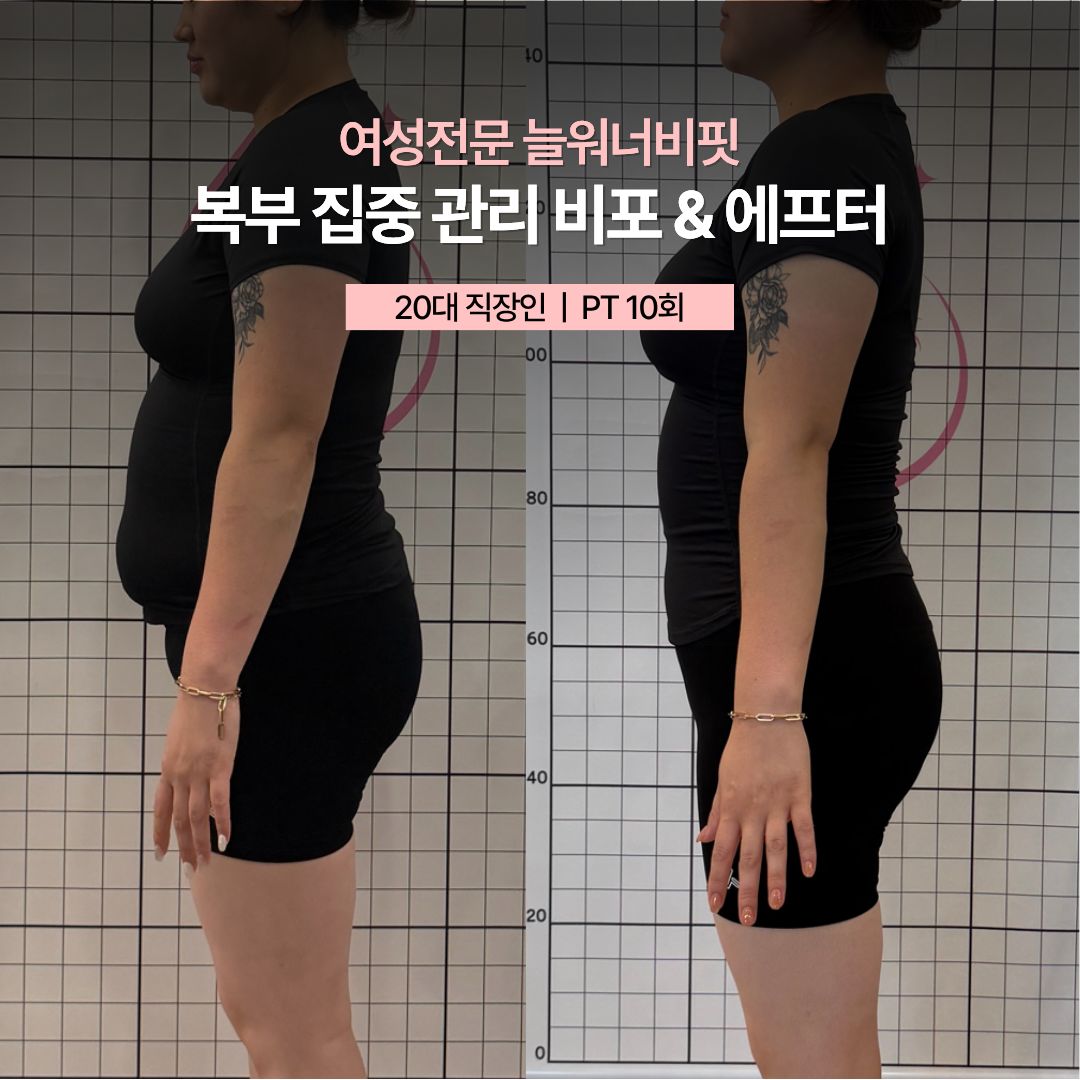 복부 집중 관리 비포 애프터, 20대 직장인 · PT 10회