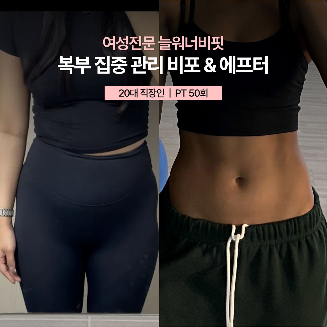 복부 집중 관리 비포 애프터, 20대 직장인 · PT 50회