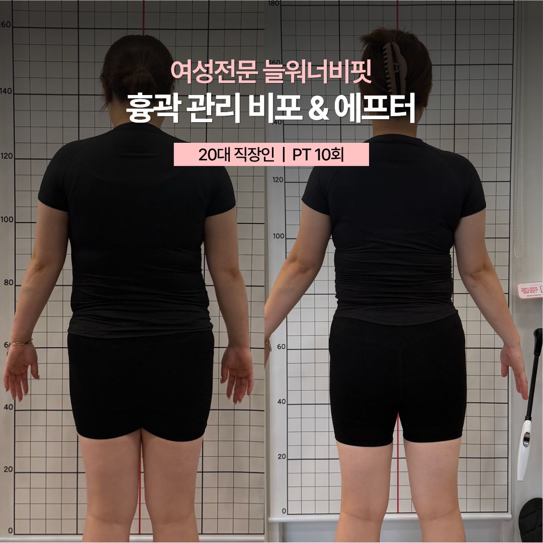 흉곽 관리 비포 애프터, 20대 직장인 · PT 10회